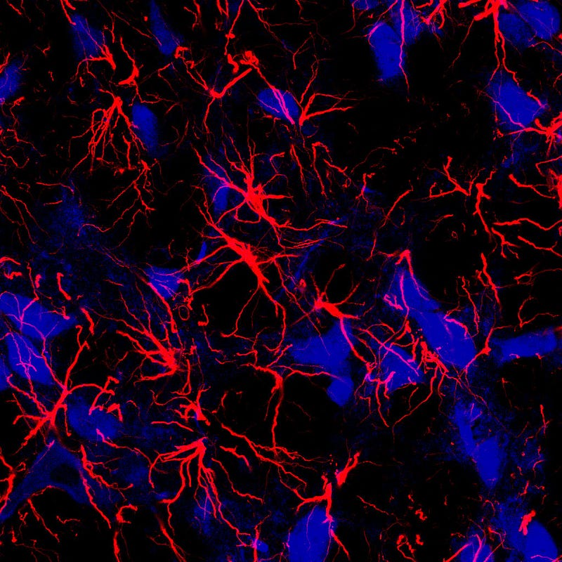 Astrocytes and their role in brain health