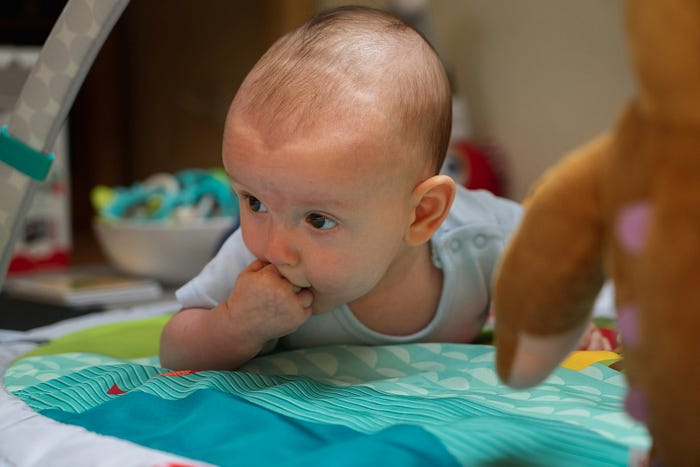 Image illustrating tongue-tie in infants