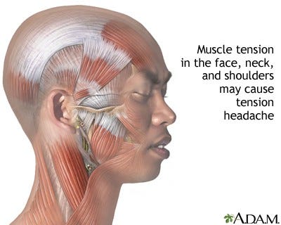 Migraine pain illustration